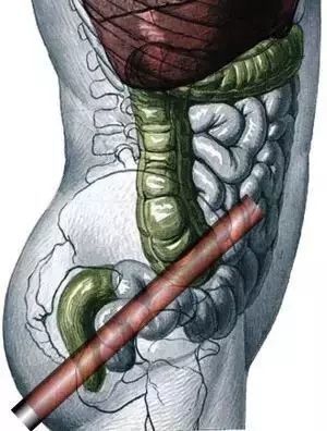 公路战争：狂怒